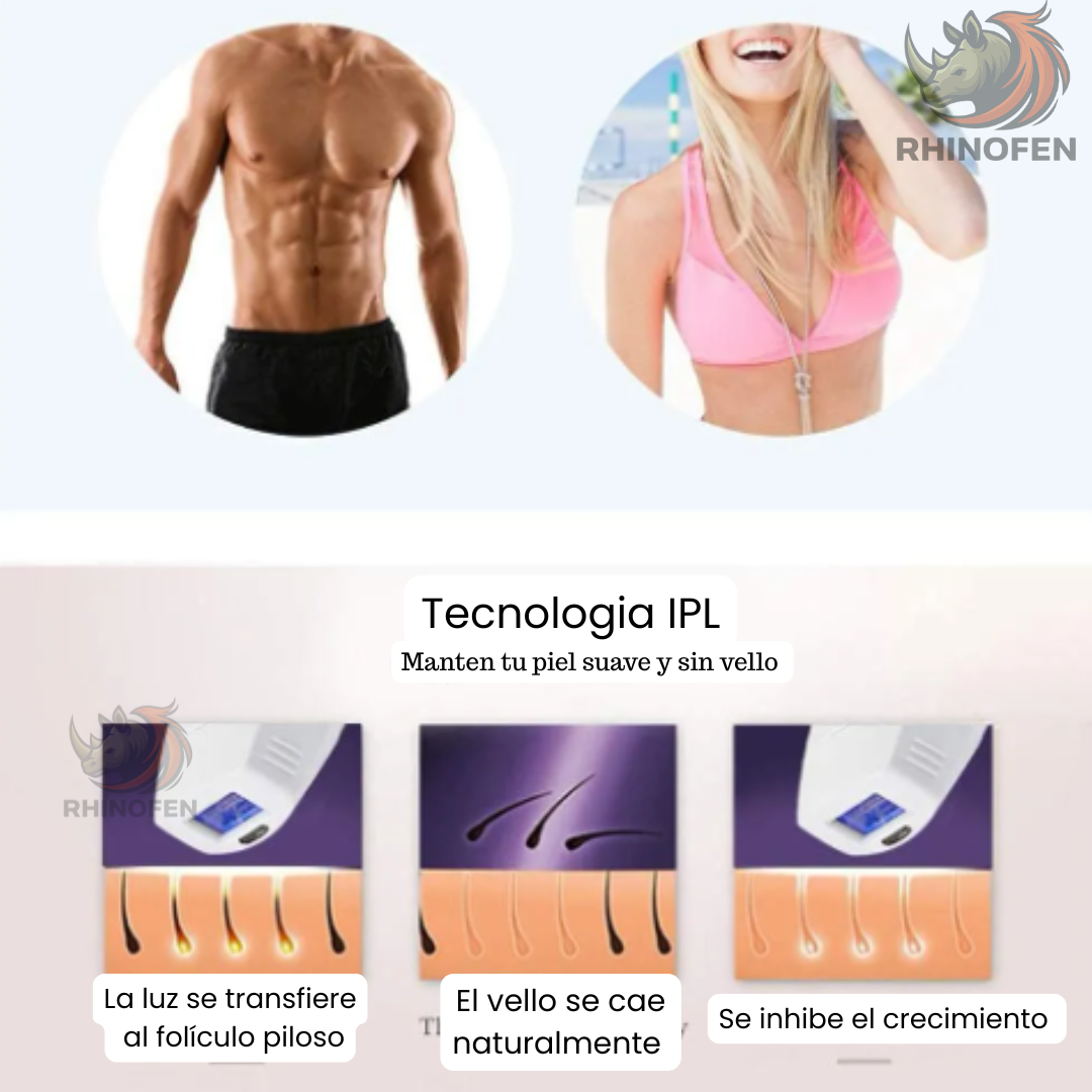 Depiladora Laser 300 Mil Disparos Corporal Rosa
